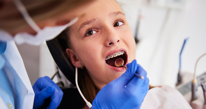 How do I Care for My Child's Teeth?